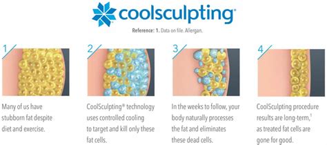coolsculpting centennial|CoolSculpting Centennial .